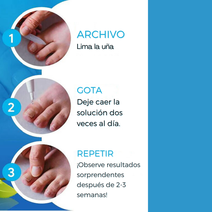 ¡3 KITS DE TRATAMIENTO DE HONGOS EN LAS UÑAS!